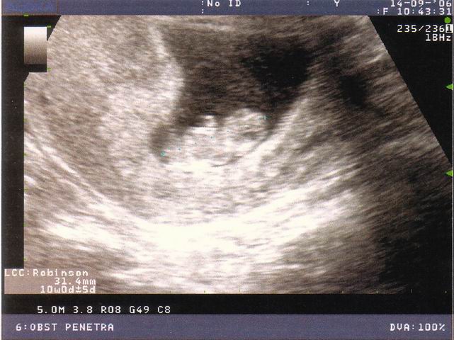 2006.09.14 echo1.jpg